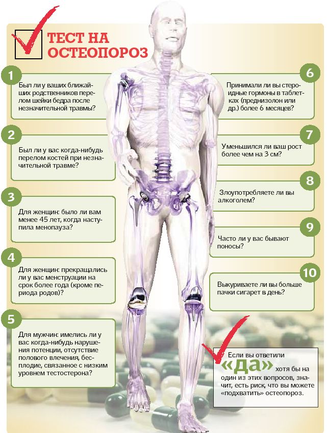 Algoritm de reabilitare a oaselor
